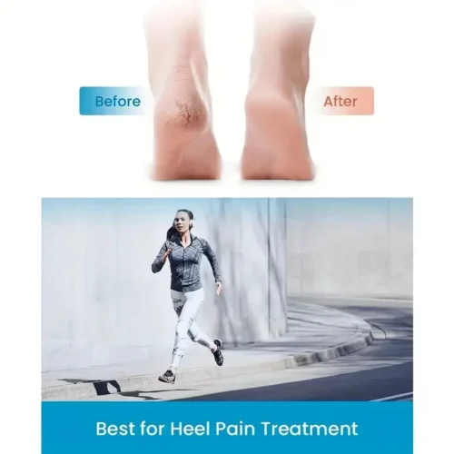 Silicone Heel Cushions for Cracked Feet